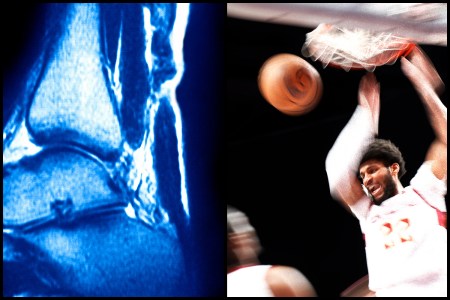 In profiling a legendary, Harvard-educated M.D., I began to see the preventative power of movement data. 